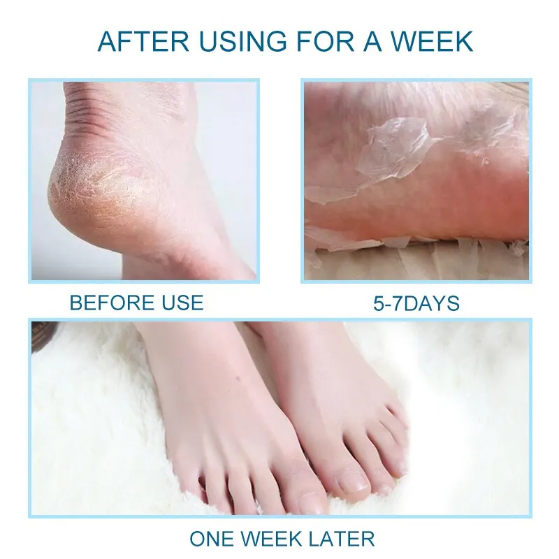 Exfoliating Foot Peeling Mask - 4 Pack